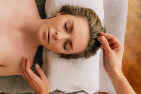 Acupuncture "Facials"